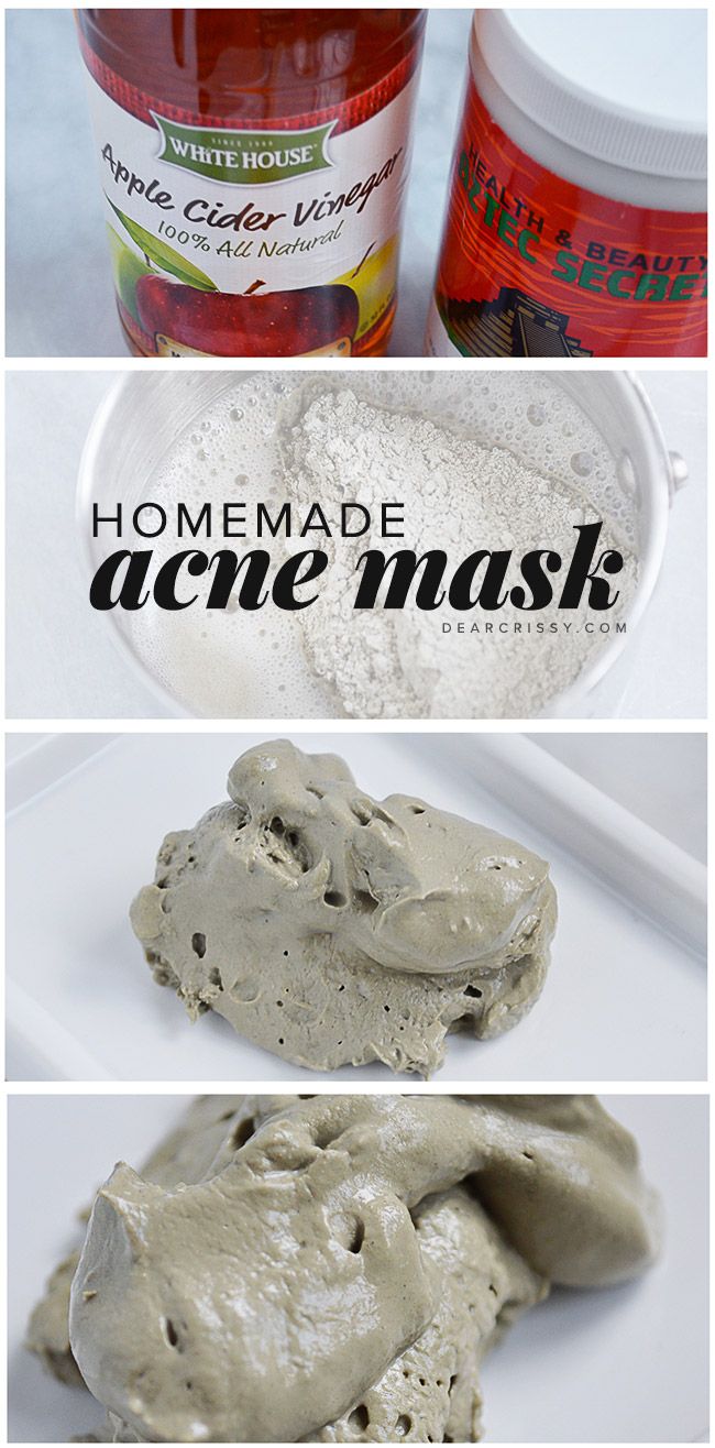 Homemade Acne Mask, Diy Acne Mask, Big Muscle, Crochet Cowls, Arabic Recipes, Rock Clothing, Acne Mask, Diy Acne, Guy Tang