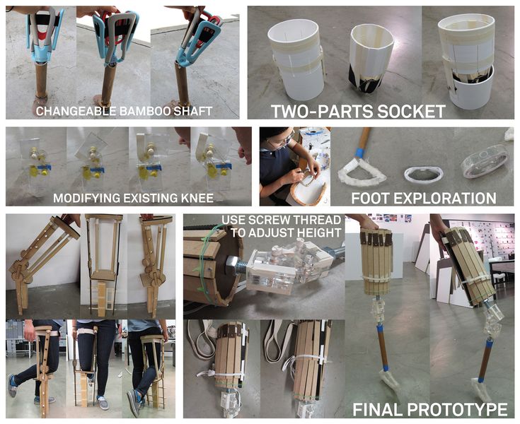 The check point of my study was, if a child's limb is (above-knee) amputated, one of the growth plates near the knee will be removed so their stump will remain sized as a child's even after they become adults. Once the thigh socket fit into the amputated limb, there will mainly be height changes between the socket and knee, and between the knee and the ankle. Prosthetic Leg, A Child, The Knee