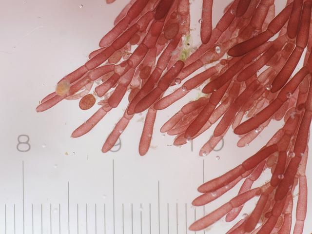 an image of some red blood cells on a white surface with a ruler in the foreground