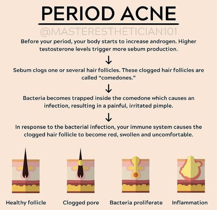 Skin Anatomy, Skin And Hair Clinic, Skin Facts, Skin Therapist, Skin Advice, Skin Aesthetics, Basic Skin Care Routine, Clear Skin Tips, Aesthetic Clinic