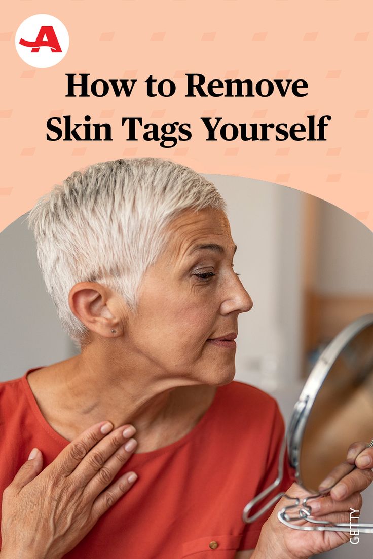 You can try this at home, but some methods are safer than others, and a visit to the dermatologist ﻿m﻿a﻿y﻿ ﻿b﻿e﻿ best. Remove Skin Tags, Glitch In The Matrix, Throwback Pictures, Skin Tags, Home Health Remedies, The Matrix, Health Info, Health And Beauty Tips, Natural Medicine