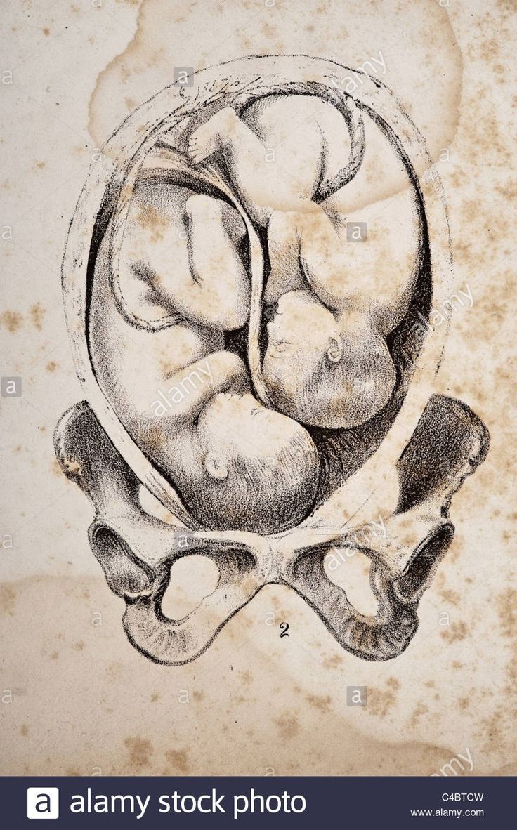 an old drawing of a baby's head and bones