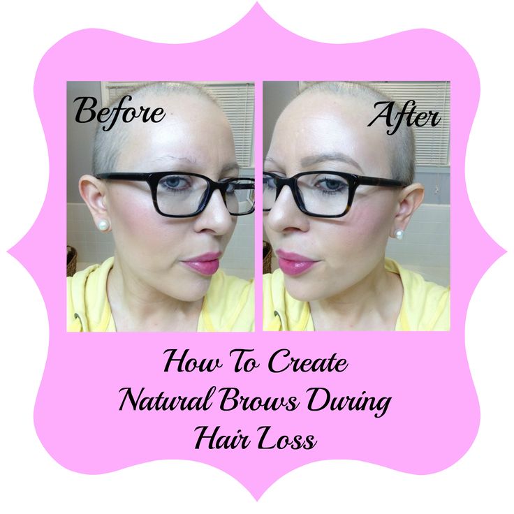 Hair loss can be devastating and it is an unfortunate side effect of most chemotherapy cocktails. Luckily, there are wigs, head scarfs, and hats if you don’t feel comfortable rocking your bald head. You may become surprisingly comfortable with the bald head look like I did.  Losing your eyebrows on the other hand can beRead More Chemo Care, Female Pattern Baldness, Sparse Brows, Chemo Hair, Growing Hair, Natural Brows, Natural Eyebrows, Lost Hair, Just In Case