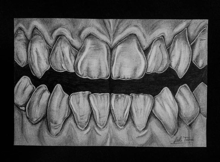 Teeth And Gums Drawing, Teeth Sketch Anatomy, Denture Drawing, Dental Anatomy Drawing, Teeth Drawings, Dental Drawings, Braces Drawing, Sharp Teeth Drawing, Teeth Sketch