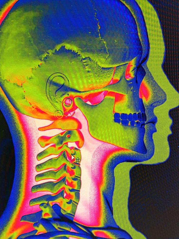 an image of a man's head and neck with the skeleton highlighted in neon colors