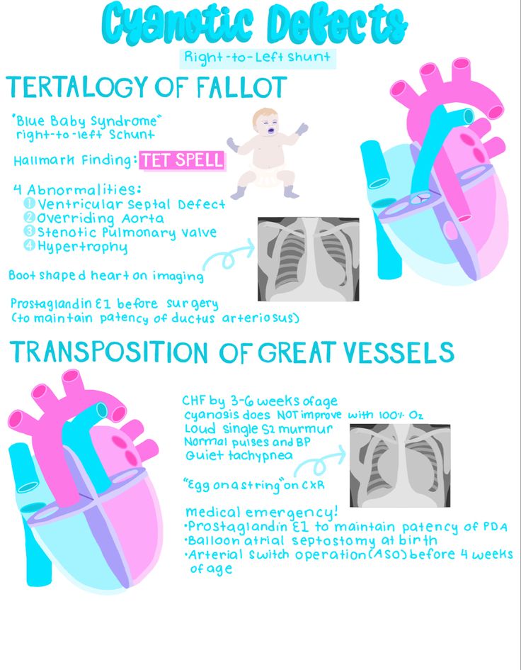 an info sheet describing the different types of heart valves