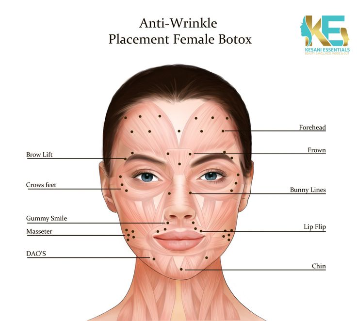 #aesthetic #botoxinjections #medspa Botox Lip Flip, Botox Injection Sites, Injection Sites, Botox Injection, Lip Flip, Botox Filler, Muscles Of The Face, Botox Lips, Aesthetic Dermatology