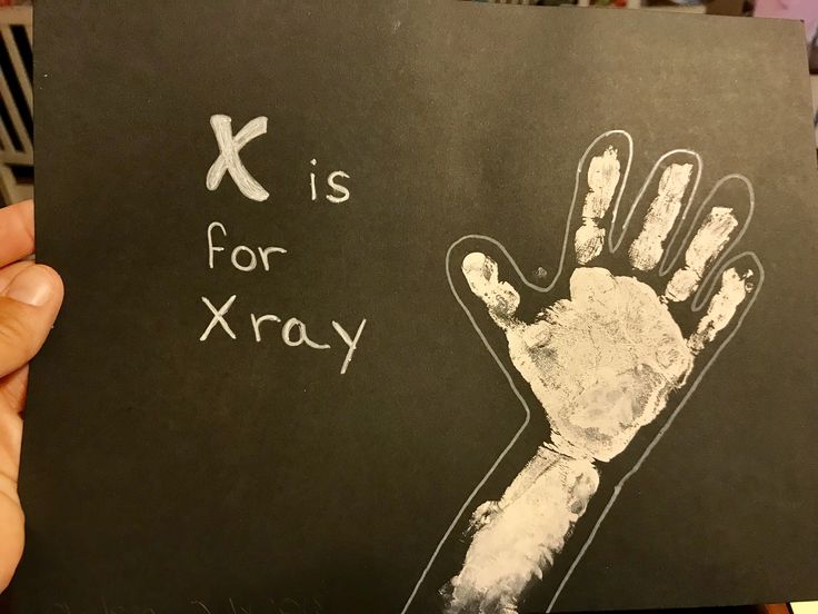 a person holding up a handprinted sign that says x is for x - ray