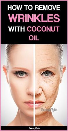 How to Remove Wrinkles with Coconut Oil Coconut Oil For Wrinkles, Coconut Oil Facial, Wrinkle Remedies, Coconut Oil Skin Care, Anti Wrinkle Skin Care, Skin Care Wrinkles, Coconut Oil For Skin, Wrinkle Remover, Anti Aging Skin Products