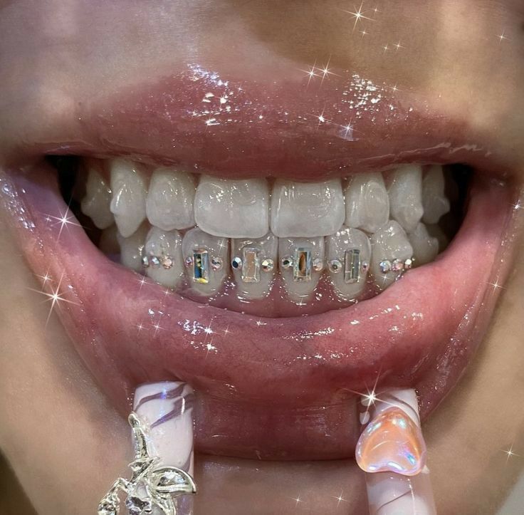 Bottom Tooth Gem, Tooth Bling, Tooth Gem Designs, Teeth Bling, Teeth Gems, Baguette Chain, Pretty Teeth, Dental Jewelry, Grillz Teeth