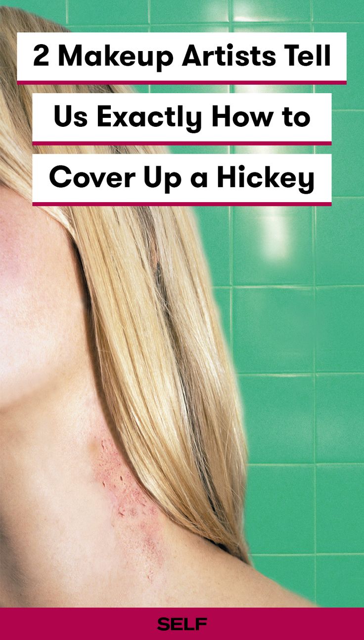 Hickey removal isn't easy, so the best way to hide it is to you makeup. Two makeup artists share how to use foundation, concealer, and color correcting to make your hickey less noticeable. Covering A Hickey With Makeup, How To Hide Hickeys With Makeup, How To Hide A Hickey With Makeup, How To Cover A Hickey Fast, Hickey Cover Up Makeup, How To Cover Up A Hickey, How To Cover A Hickey With Makeup, Hickey Removal Quick, How To Get Rid Of A Hickey Fast