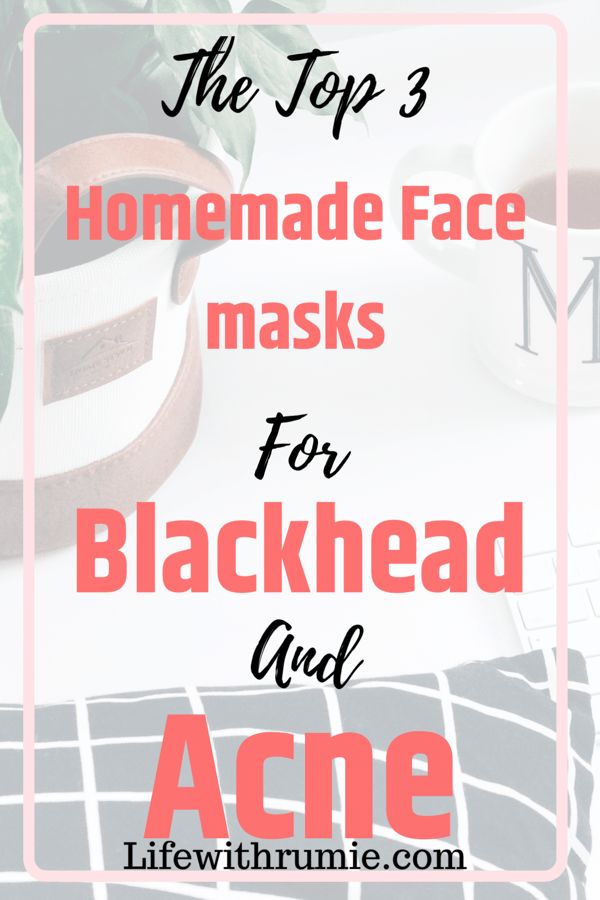 Homemade face masks for blackhead and acne that actually work - Life with rumie Pimple Mask, Face Mask For Blackheads, Blackhead Mask, Acne Face Mask, Diy Acne, Cheap Skin Care Products, Brown Spots On Face, Face Face, Mask Diy