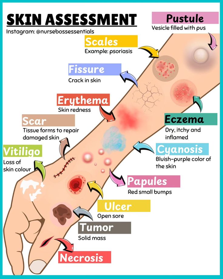 the different types of skin and how they are used to help them understand what it's like