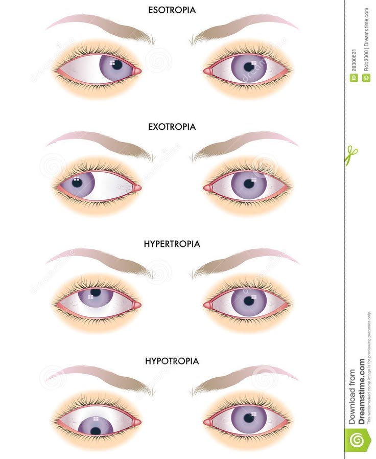 the different types of eyes and how they are used for each eye color, from blue to purple