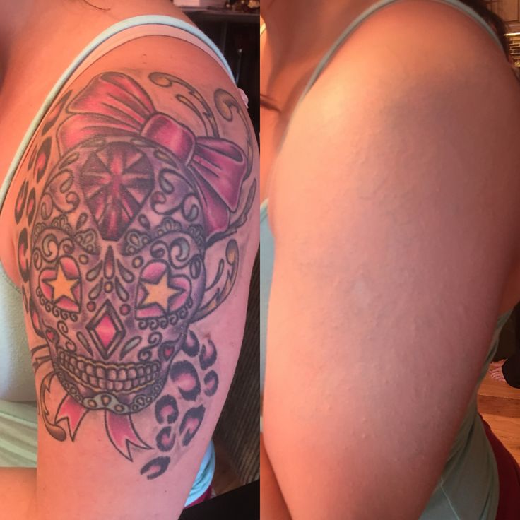 two women with tattoos on their arms, one has a skull and the other has a bow