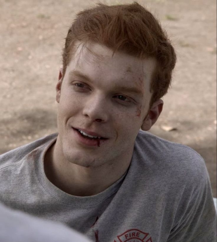 a young man with blood on his face sitting in front of an open fire hydrant