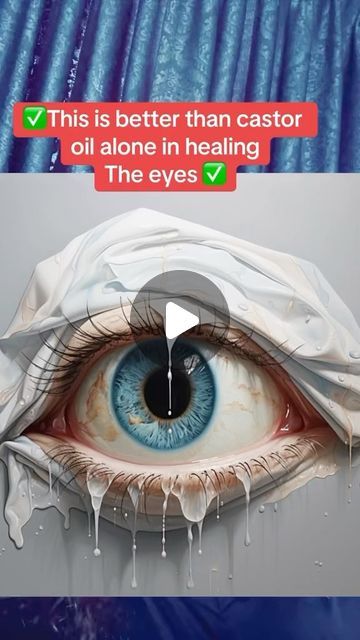 Raw (Mourab) Maraby on Instagram: "✅ Even better than castor oil alone to heal your eyes ✅ #eyepressure #eyefloaters t #cataract 👉Try it https://miraherbals.info/products/poke-root-and-castor-oil?_pos=3&_psq=poke&_ss=e&_v=1.0" Castor Oil In Eyes, Castor Oil For Eye Floaters, Castor Oil For Eyesight, Poke Root Benefits, Swollen Eyelids Remedy, Castor Oil For Eyes, Poke Root, Eye Health Remedies, Swollen Eyelid