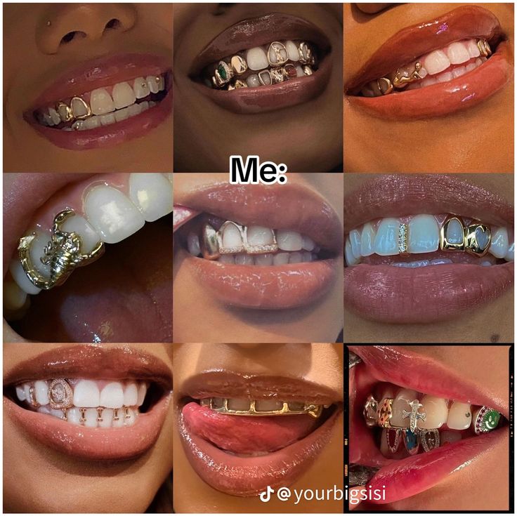 many different types of teeth with braces and piercings on them are shown in this collage