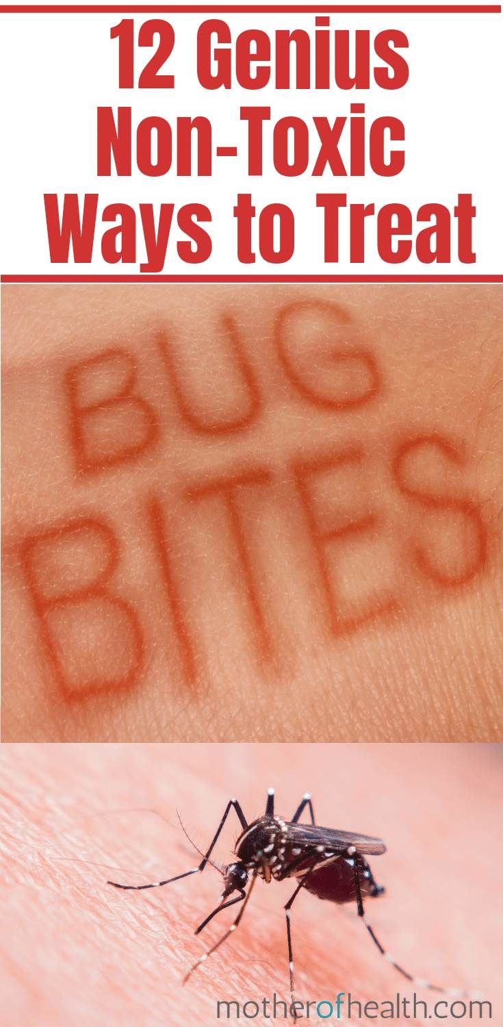 a mosquito with the words, 12 genius non - toxic ways to treat