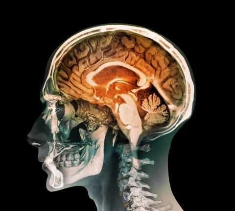 the human head is shown with an x - ray view of it's brain