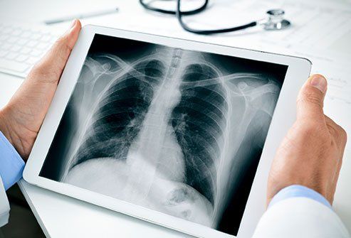 a doctor holding an x - ray in front of a tablet computer with the image of a chest on it