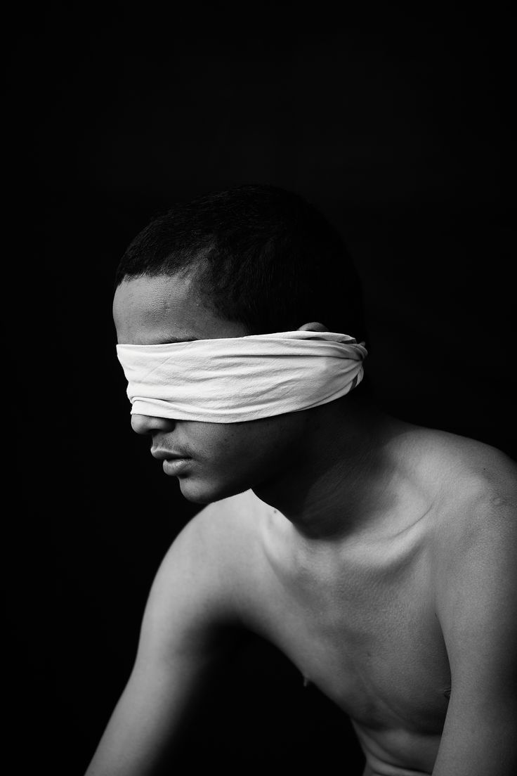 a shirtless man with a bandage on his face and blind folded over his eyes