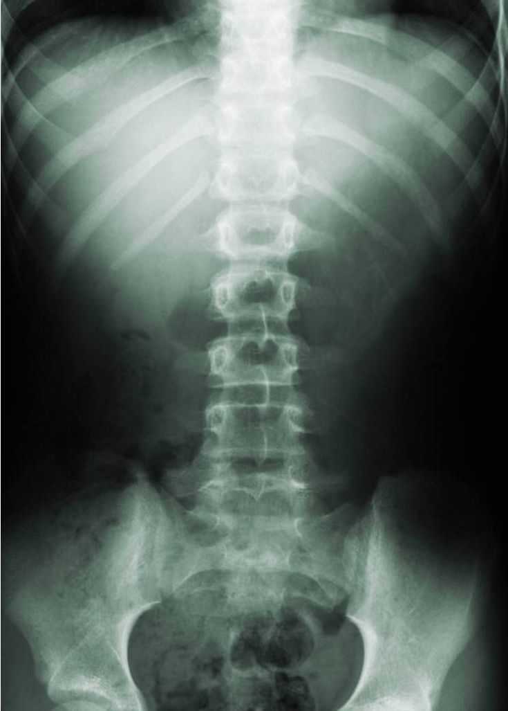 an x - ray image of a man's torso and back with light coming through it