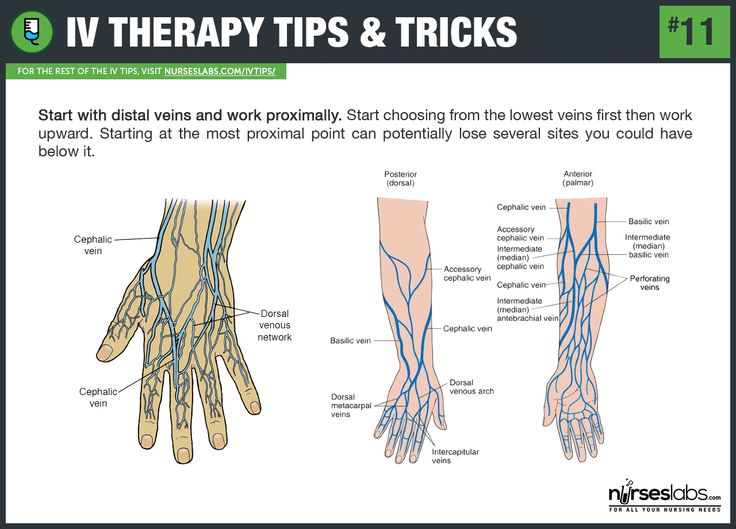 an image of the wrist and hand with different types of veins on it, labeled in