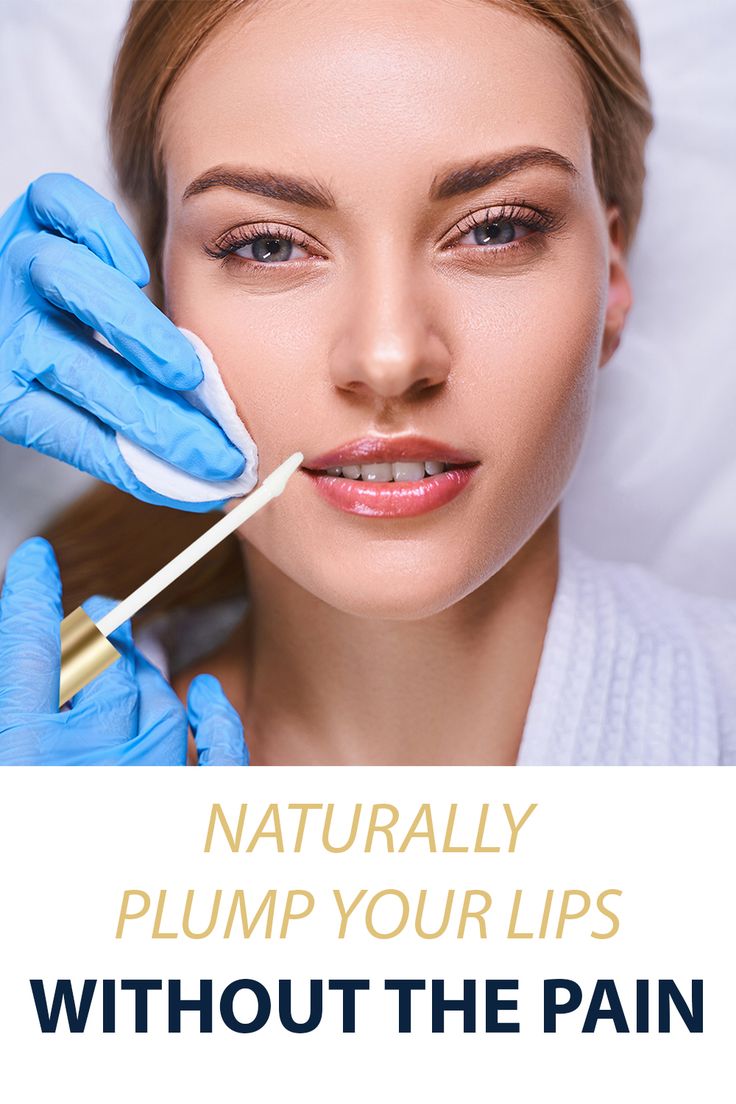 Beauty Industry Experts Agree This is a Great Solution for Younger, Plumper Looking Lips! Plump Lips Naturally, Lip Hydration, Beautiful Lips, Soft Lips, Dry Lips, Lip Plumper, Beauty Industry, Lip Care, Beauty Make Up