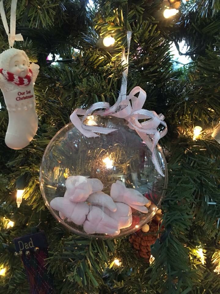 an ornament hanging from a christmas tree filled with baby's feet and stockings