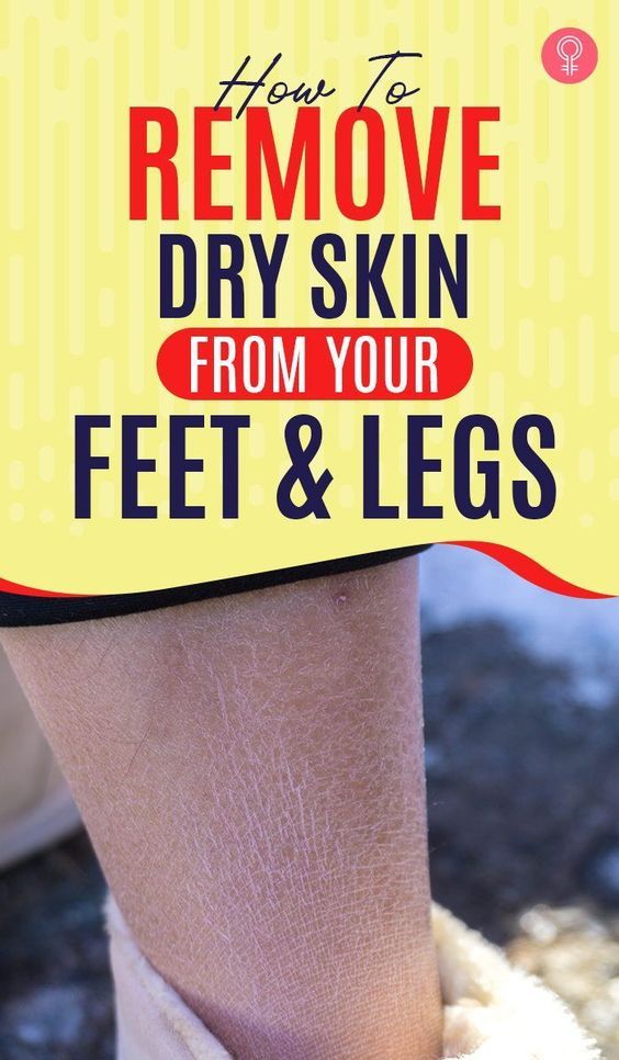 Board name Dryskin Skincare, Dry Legs, Dead Skin Removal, Dry Flaky Skin, Dry Skin Remedies, Scaly Skin, Home Remedies For Hair, Foot Soak, Coconut Oil Hair