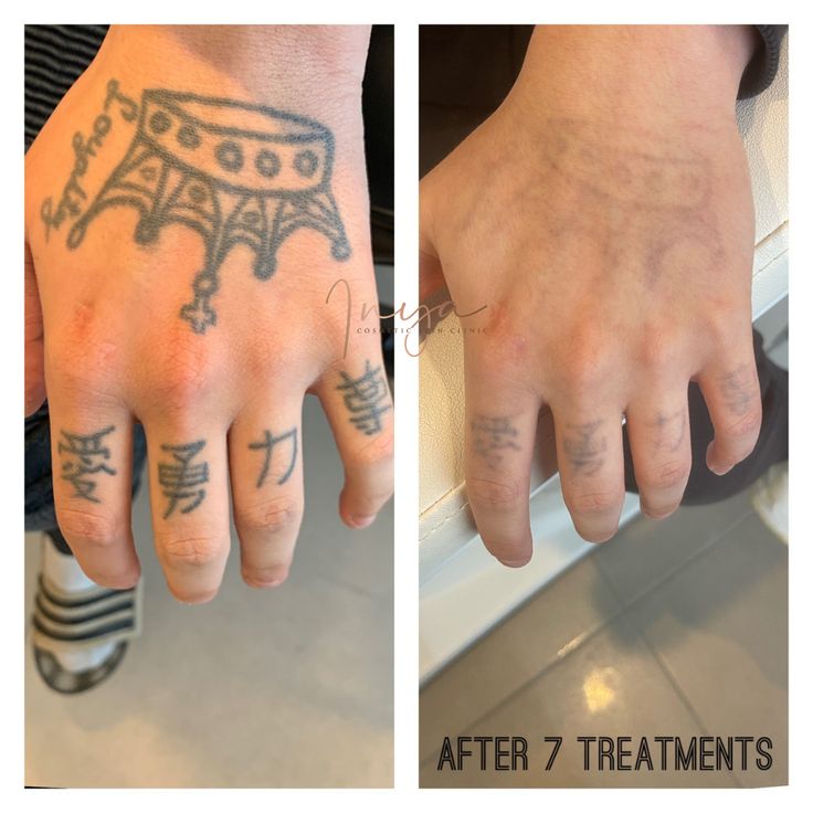 before and after photos of someone's hand with tattoos on it, the left hand has been inked