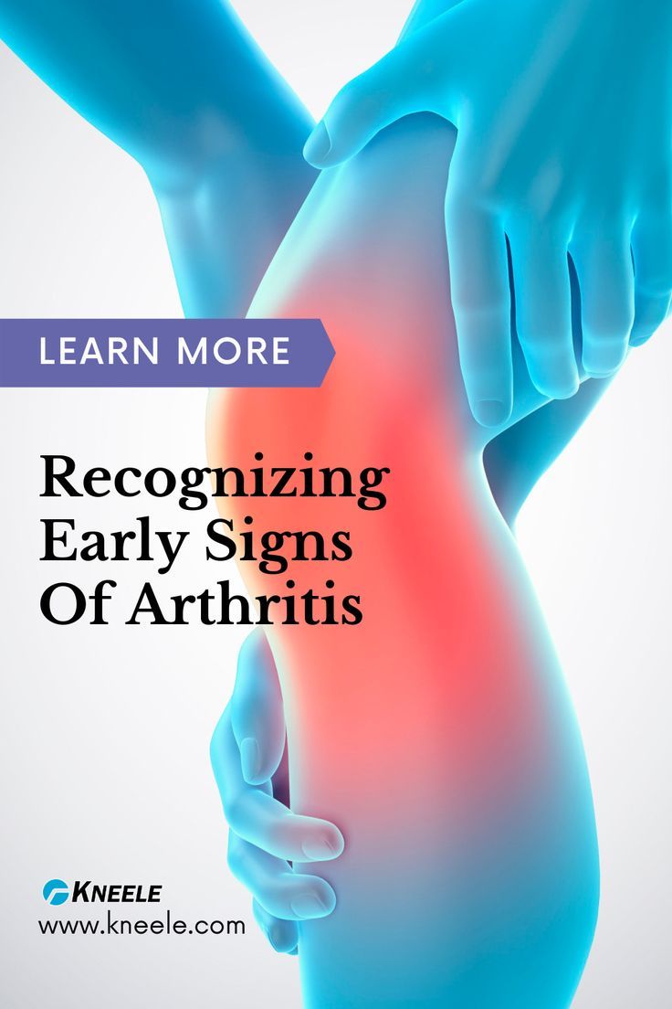 https://kneele.com/blog/6-early-signs-of-arthritis-in-your-knee-what-to-do/?mtm_source=pinterest&mtm_medium=social&mtm_campaign=repin_kneebody&mtm_content=KN2022110001&mtm_kwd=arthritisknee,kneearthritis,kneepain,jointpain,kneedamage,arthritis,arthritissymptoms,knee&mtm_cid=&mtm_group=&mtm_placement= Knee Pain Remedy, Knee Pain Relief, Nerve Pain, Knee Pain, Holistic Healing, Pain Relief, Home Remedies, Signs