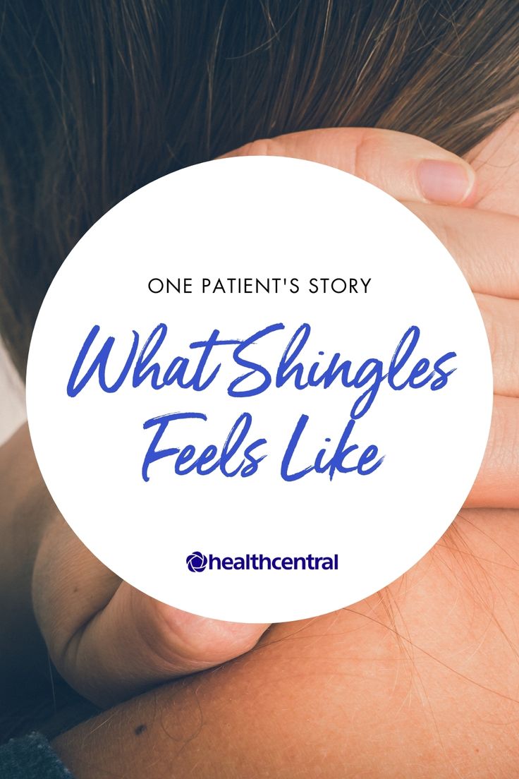 Symptoms Of Shingles, Shingles Symptoms Signs, Shingles On Face, Signs Of Shingles, What Causes Shingles, Shingles Pain Relief, Shingles Symptoms, Shingles Remedies, Shingles Relief