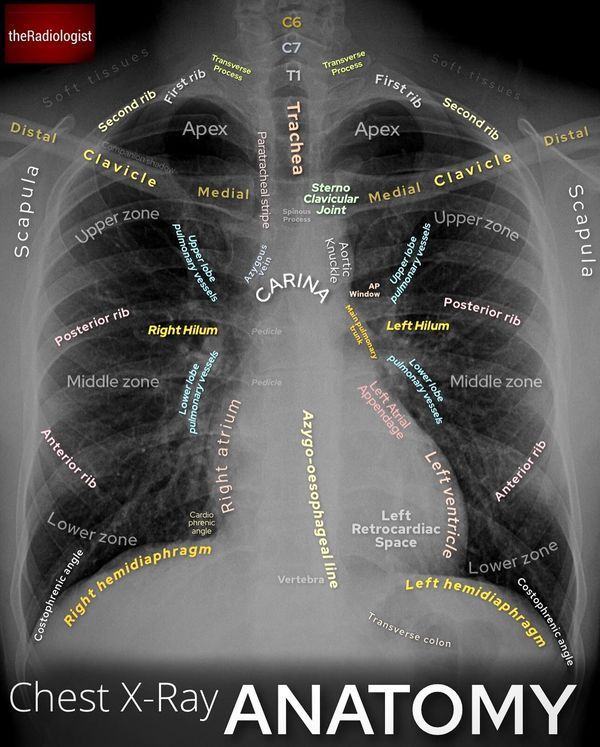 chest x - ray anatomy with words written in the upper left hand corner and on the right