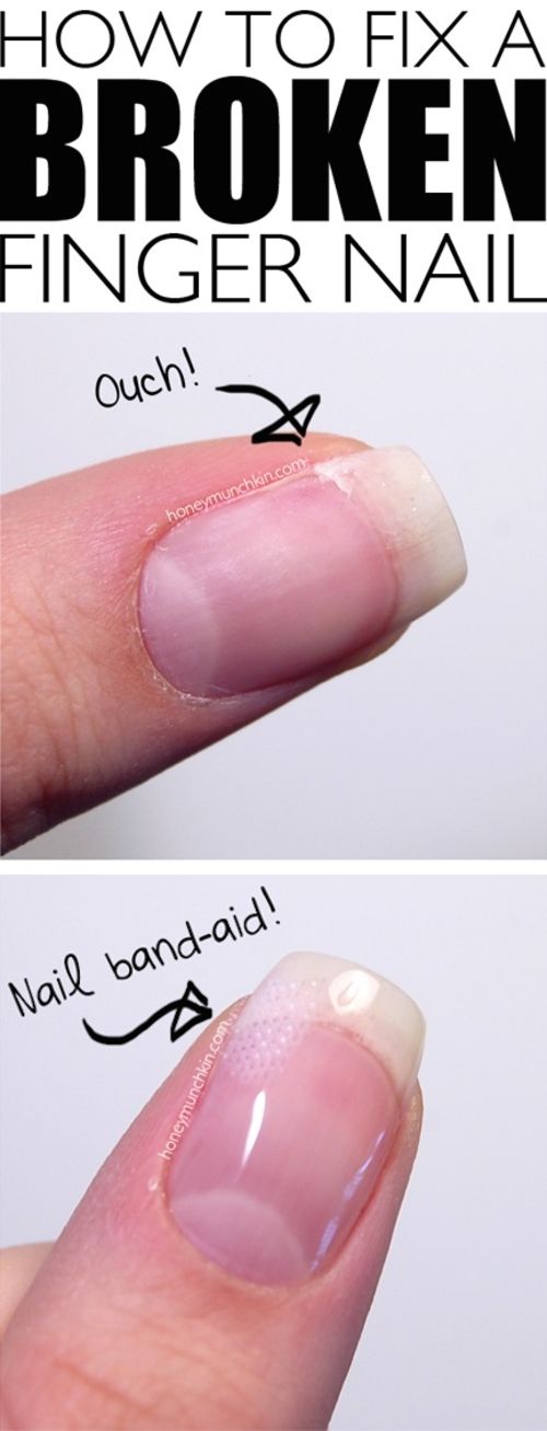 Fix Broken Nail, Repair Broken Nail, Broken Finger, Nail Hardener, Unghie Nail Art, Broken Nails, Nail Fungus, Diy Life Hacks, Cleaning Tips