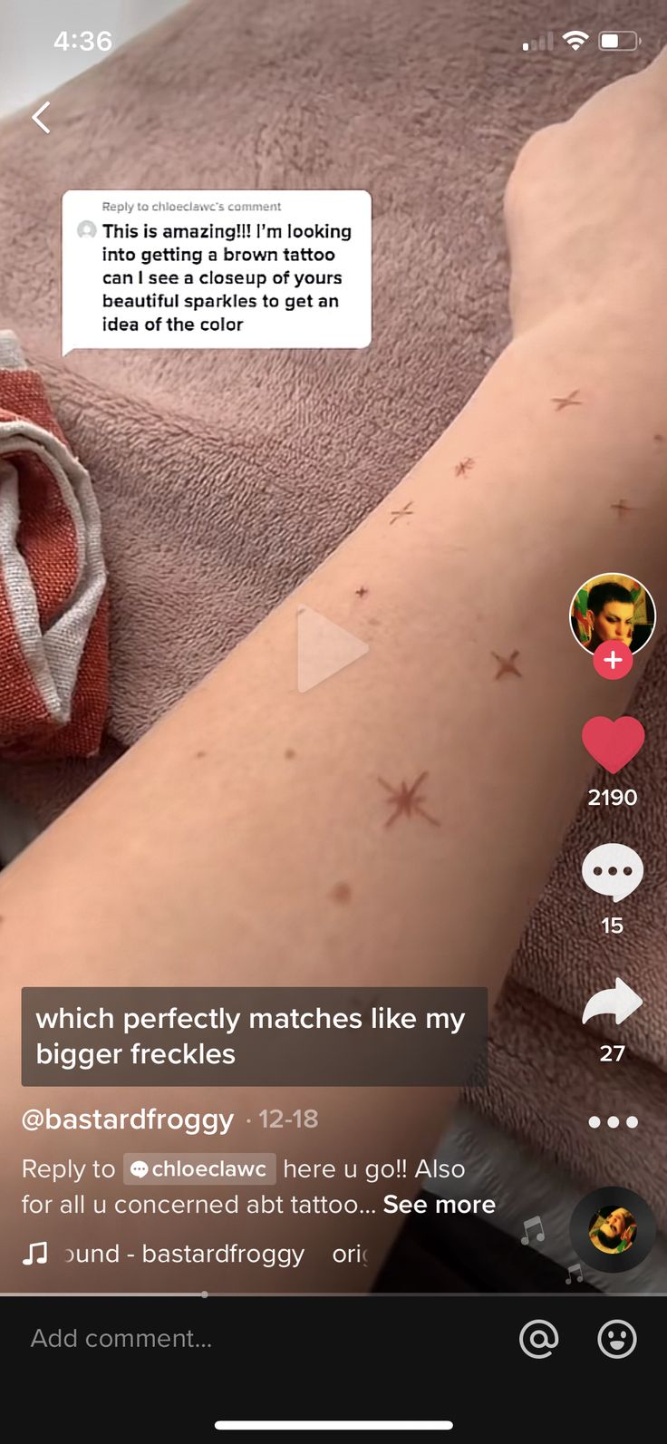 an image of someone's arm with some brown spots on it and the text, which perfectly matches like my bigger frecks