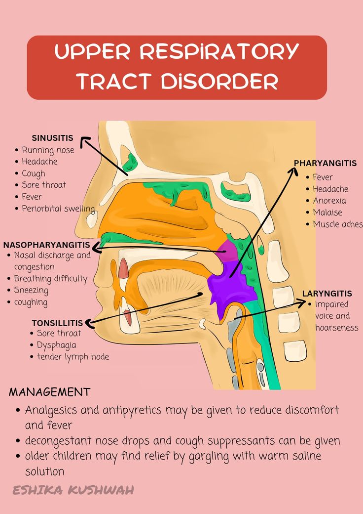 the upper respiratory traci disorder is shown in this diagram, which shows