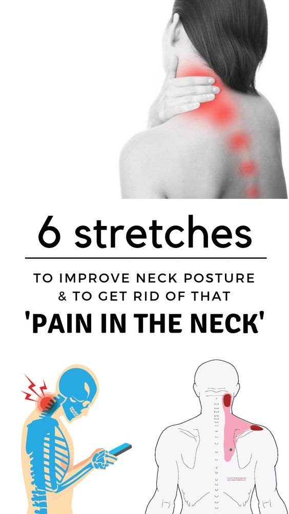 Sore Neck Relief, Neck Pain Relief Stretches, Neck Muscle Pain, Neck Pain Stretches, Neck Posture, Neck Exercise, Forward Head Posture Exercises, Neck Pain Exercises, Nervus Vagus