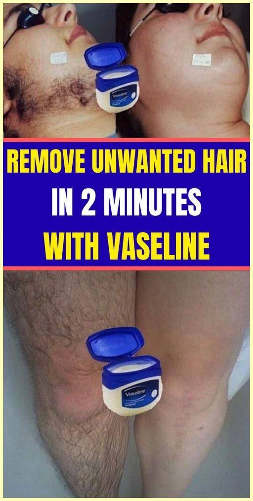 Remove Unwanted Hair - At Home, With Vaseline by Moises Wood | This newsletter was created with Smore, an online tool for creating beautiful newsletters for educators, nonprofits, businesses and more Unwanted Hair Permanently, Remove Unwanted Hair, Underarm Hair Removal, Health Signs, Hair Removal Methods, Facial Hair Removal, Hair Removal Permanent, Body Hair Removal, Hair Removal Cream