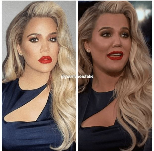 Instagram Vs Real Life Celebrities, Celebrity Real Bodies, Cheek Implants, Dash Dolls, Instagram Vs Real Life, Botox Lips, Feeling Ugly, More Than Meets The Eye, Celebrities Before And After