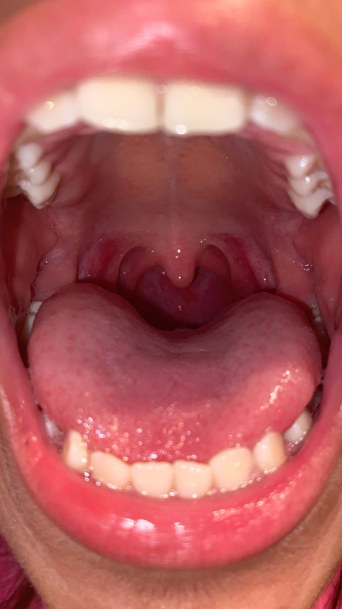 a woman's mouth with her tongue out and it is open to show the inside of