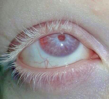 an eye with the red circle on it's iris is seen in this close up photo