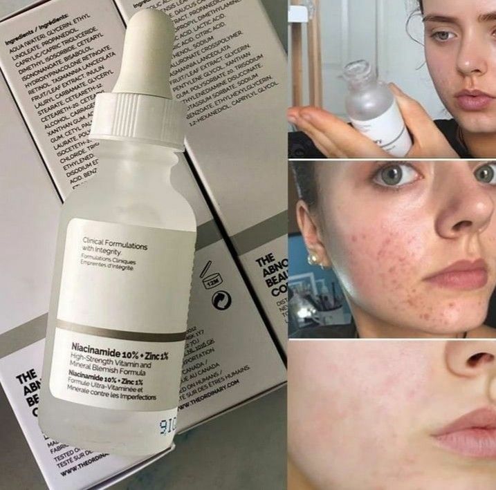 Glowing Skin By Catherine Ordinary Niacinamide, Vitamin And Mineral, Skin Care Basics, Congested Skin, Face Acne, Facial Skin Care Routine, روتين العناية بالبشرة, Moisturizing Serum, Face Hydration