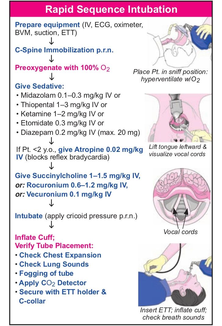 the instructions for rapid sequence inflibation