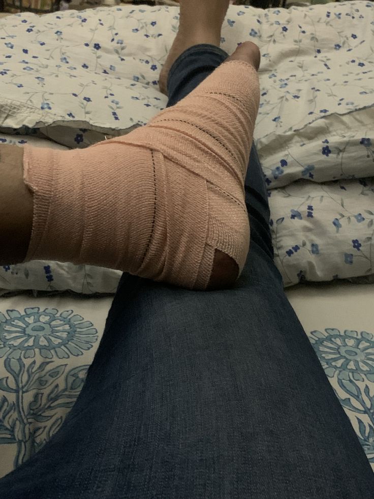 a person with a cast on their leg sitting on a bed