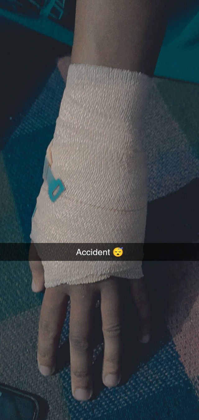 Broken Hands Fake Story, Hath Kaatne Wala Photo, Accident Hand Dpz, Hand Fracture Pics, 2000 Wallpaper, Saraswati Photo, Bike Accident, Hospital Admit, Couples Hidden Face Pics