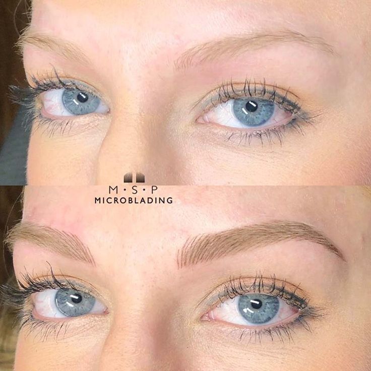 Eyebrow Shaping Blonde, Microblading Eyebrows Redhead, Blonde Microblading Eyebrows, Nano Eyebrows, Eyebrows Blonde Hair, Microblading Eyebrows Before And After, Blonde Hair And Eyebrows, Blonde Microblading, Blonde Brows