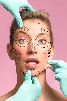 Extreme Plastic Surgery, Plastic Surgery Gone Wrong, Facial Contouring, Plastic Surgery Procedures, Celebrity Plastic Surgery, Neck Lift, Beauty Clinic, Popsugar Beauty, Beauty Standards