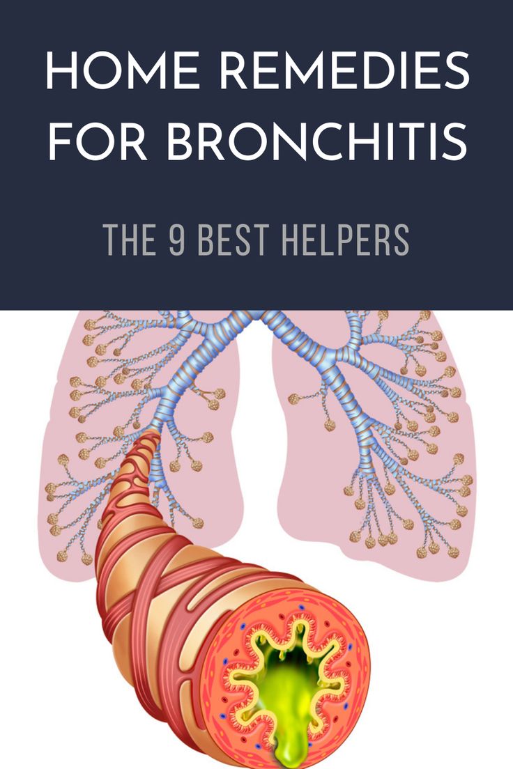 Remedies For Bronchitis, Natural Remedies For Bronchitis, Hangover Headache, Home Remedies For Bronchitis, Best Cough Remedy, Losing 40 Pounds, Home Remedy For Cough, Natural Cold Remedies, Healthy Diet Tips